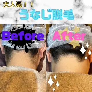 メンズ キッズ 男女同額完全個室脱毛 LEPIA内田のエステ・リラクイメージ