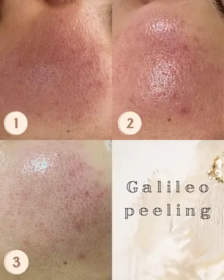 Life＆ Beautifulのエステ・リラクイメージ