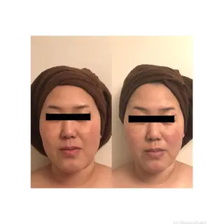 おうちサロン B-ROOMのエステ・リラクイメージ