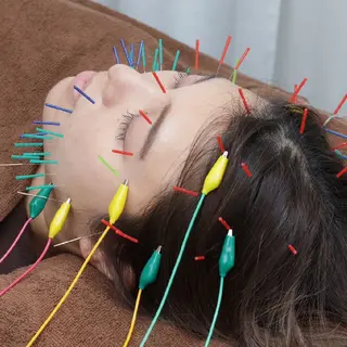 メンズ Spring鍼灸院所属・Spring鍼灸院 ✨首肩こり、腰痛に！のエステ・リラクイメージ