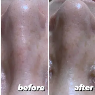 EMILU CAのエステ・リラクイメージ