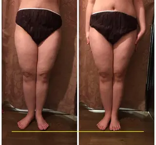 代表 MOMOのエステ・リラクイメージ