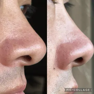 メンズ 美Face所属・美 Faceのエステ・リラクイメージ