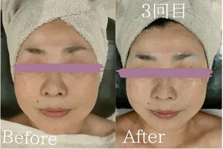 美肌脱毛＆小顔・フェ イシャル【SONA】のエステ・リラクイメージ