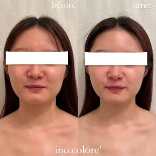 エステサロンino.colore'所属・小顔サロン ino.coloreのエステ・リラクイメージ