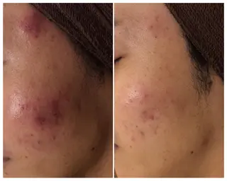 ミディアム カラー パーマ ヘアアレンジ メンズ キッズ ネイル マツエク・マツパ ニキビ・肌質改善専門 ♡人生が変わるサロンのエステ・リラクイメージ