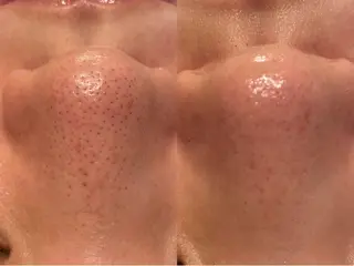 La・Bellvie所属・La･Bellvie 【星ヶ丘店]のエステ・リラクイメージ