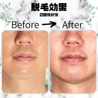 メンズ キッズ 男女同額完全個室脱毛 LEPIA内田のエステ・リラクイメージ