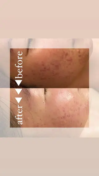 hm NATURESKINのエステ・リラクイメージ