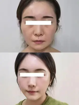 マツエク・マツパ aliaハイフ&水光ジェットサロン所属・aliaハーブ水光店 エステティシャン募集のエステ・リラクイメージ