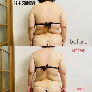 Lunon 【ルノン】のエステ・リラクイメージ