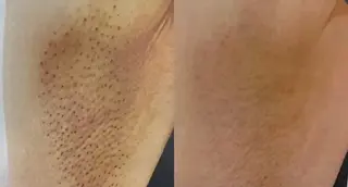 エルモサ痩身脱毛　西八王子店所属・エルモサ痩身脱毛 西八王子店のエステ・リラクイメージ