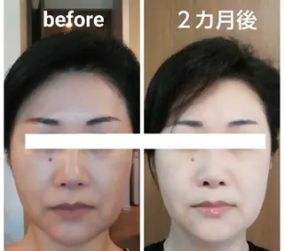 小顔と美肌 まごころエステMatoria所属・小顔 美肌専門 Matoriaのエステ・リラクイメージ