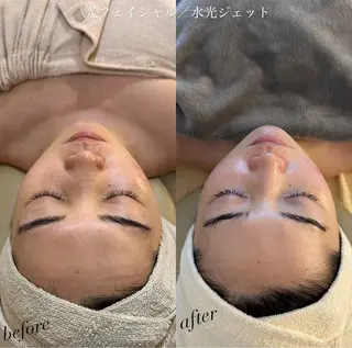 うなじ脱毛/美肌脱毛 LABELのエステ・リラクイメージ