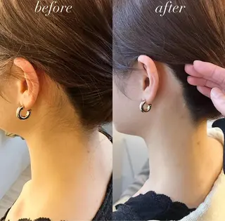 うなじ脱毛/美肌脱毛 LABELのエステ・リラクイメージ