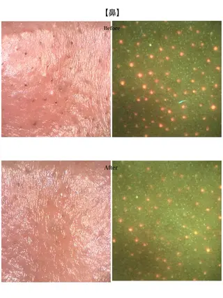 Bébé×DiDiA 野々市市役所前店のエステ・リラクイメージ