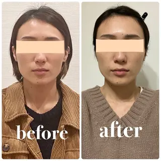 小顔矯正専門店Cream所属・菅野 もえのエステ・リラクイメージ