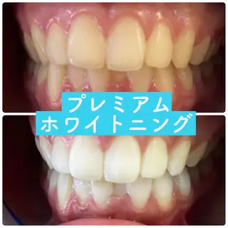 PLATINUM Beauty 横浜店所属・ホワイトニングルーム 横浜店のその他イメージ