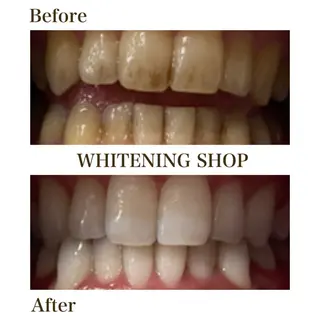 ホワイトニングショップ静岡葵区店所属・ホワイトニング ショップ葵区静岡駅店のその他イメージ