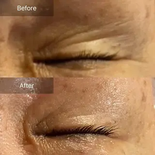 Mandarin Orange所属・毛穴から始める肌メン テマンダリンオレンジのエステ・リラクイメージ