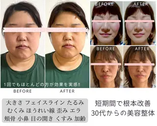 小顔矯正& 慢性肩こり腰痛改善店のエステ・リラクイメージ