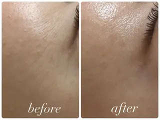 プライベートサロンCuara所属・プライベートサロン Cuaraのエステ・リラクイメージ