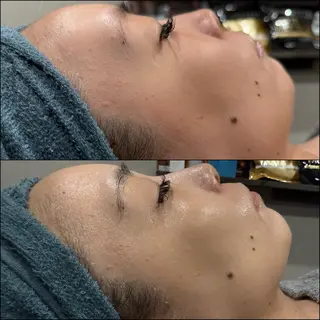 LiZA エステティックサロンのエステ・リラクイメージ