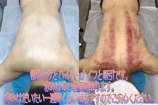 新大久保成美エステ リラックぜーションのエステ・リラクイメージ