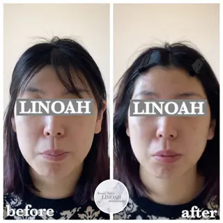 メンズ ビューティーサロン リノア心斎橋店のエステ・リラクイメージ