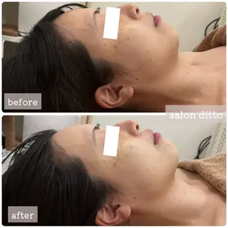salon ditto所属・mio (小顔・ヘッドスパ)のエステ・リラクイメージ