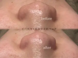 毛穴と脱毛のお店 "Lea" 壷林のエステ・リラクイメージ