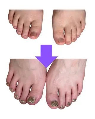 ネイル 深爪矯正専門店ネイルサロンKUU所属・ネイルサロン KUUのネイルデザイン