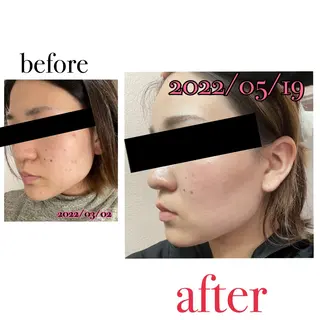 カヌレ ビューティーのエステ・リラクイメージ