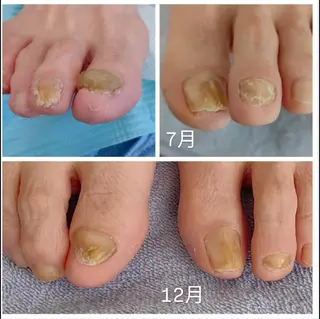 ネイル reve あやののネイルデザイン