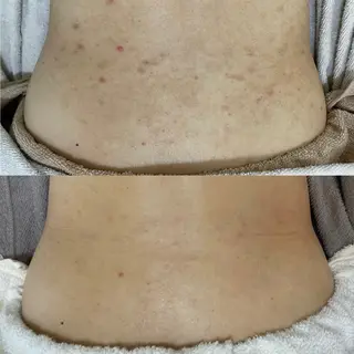 シェノン所属・ニキビ・毛穴・ フェイシャル専門店のその他イメージ