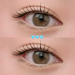 ใใใจใฏใปใใใ ๐ฒ๐ถ๐ด๐ต๐ ๐๐ข๐ก๐๐ใฎใใใจใฏใปใใใใใถใคใณ