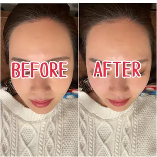 ジェイペック所属・整体×美容鍼 ジェイペックのエステ・リラクイメージ