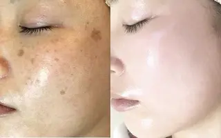 REMENTE池袋東口店所属・REMENTE🪞 KANAのエステ・リラクイメージ