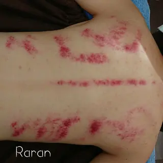 若返り 美肌   エステサロンららんのエステ・リラクイメージ