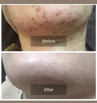 ハーブピーリング 専門店MOKA所属・ハーブピーリング専門 MOKAのエステ・リラクイメージ