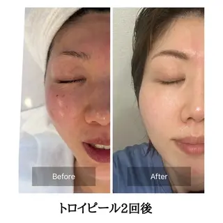 mine.mマインエム所属・mine.mi マインエムのエステ・リラクイメージ