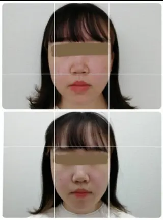 CORAL湘南平塚店所属・【小顔・美容専門】 🐠リカのエステ・リラクイメージ