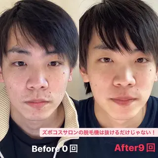 メンズ パーソナルカウンセラー付き:メンズセルフ脱毛・セルフホワイトニング専門店 ズボコスサロン笹塚所属・パーソナルセルフ脱毛 ズボコスサロンのエステ・リラクイメージ