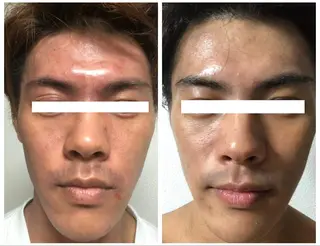 Leading Ladiesのエステ・リラクイメージ