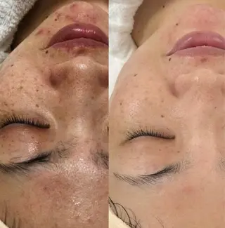 【美肌育成サロン】 エレンのエステ・リラクイメージ