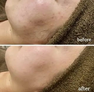 フェイシャルサロン shamrockのエステ・リラクイメージ