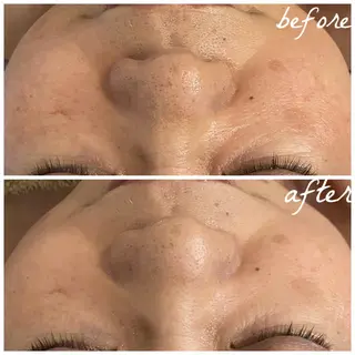 メンズ メナード岐阜市茜部 杉浦のエステ・リラクイメージ