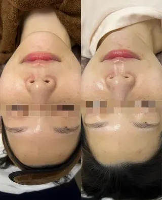 看護師が施術する ナスサロ/Emi🪽のエステ・リラクイメージ