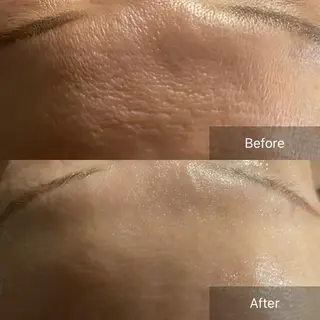 Mandarin Orange所属・毛穴から始める肌メン テマンダリンオレンジのエステ・リラクイメージ