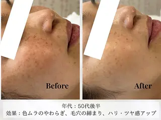 Astorie 相模大野エステのその他イメージ